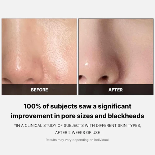 Zero Pore Pad 2.0 6